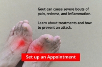 Gout Pain Can Be Managed